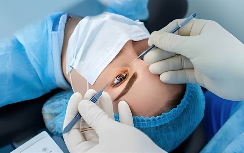 Breaking Down The Cost Of Lasik Surgery: What You Need To Know?